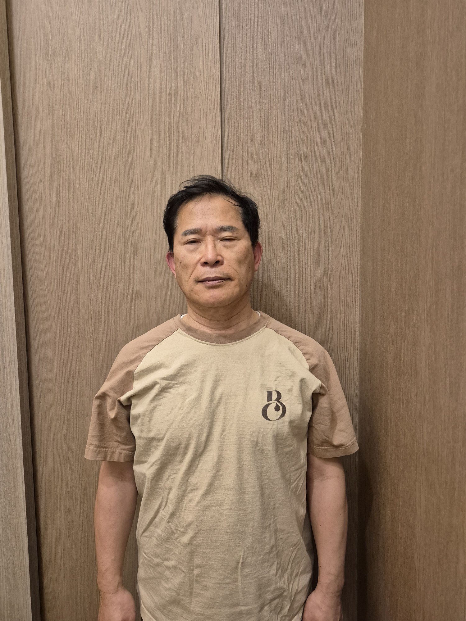 관리 후 비교 사진
