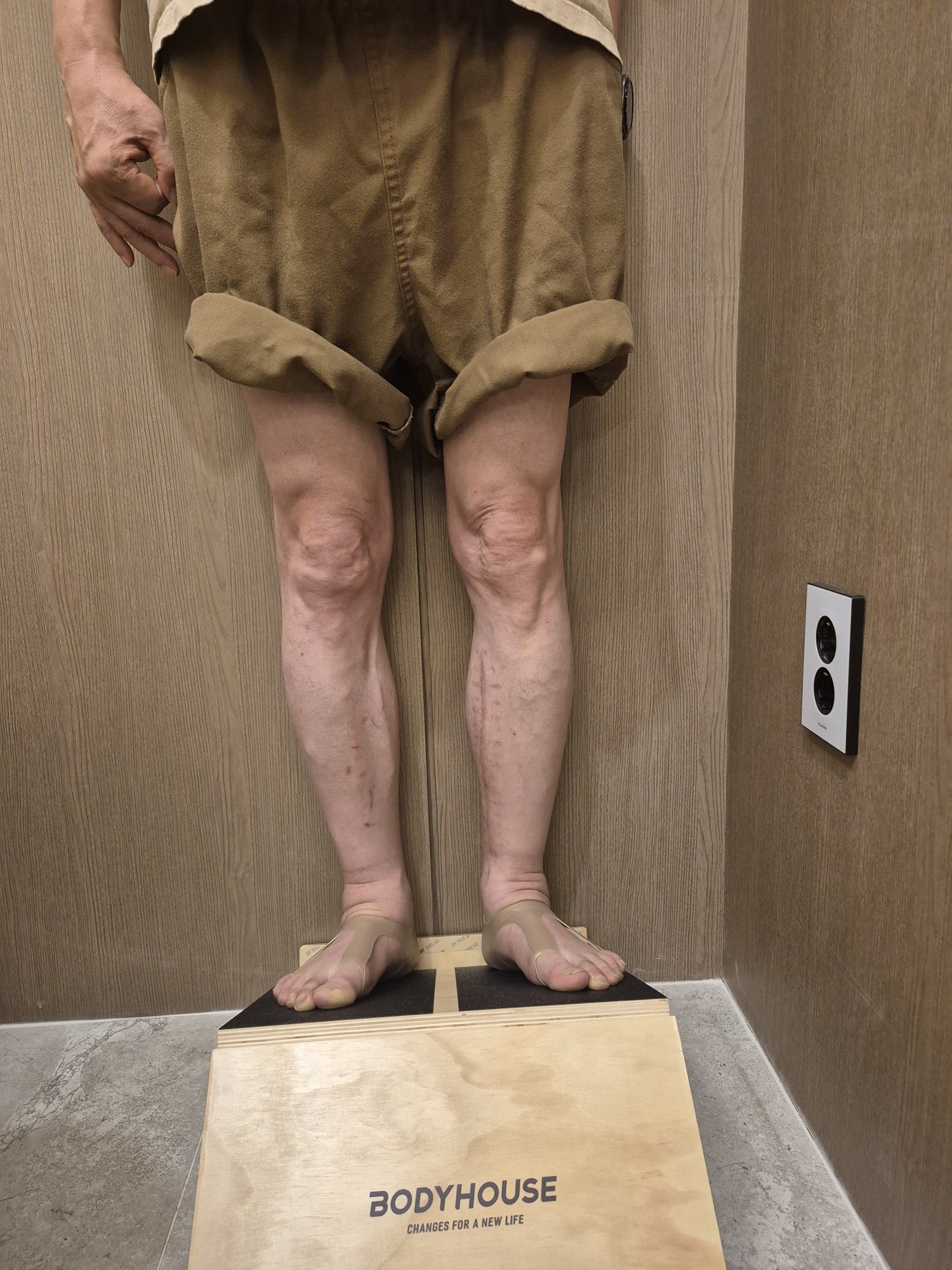 관리 후 비교 사진