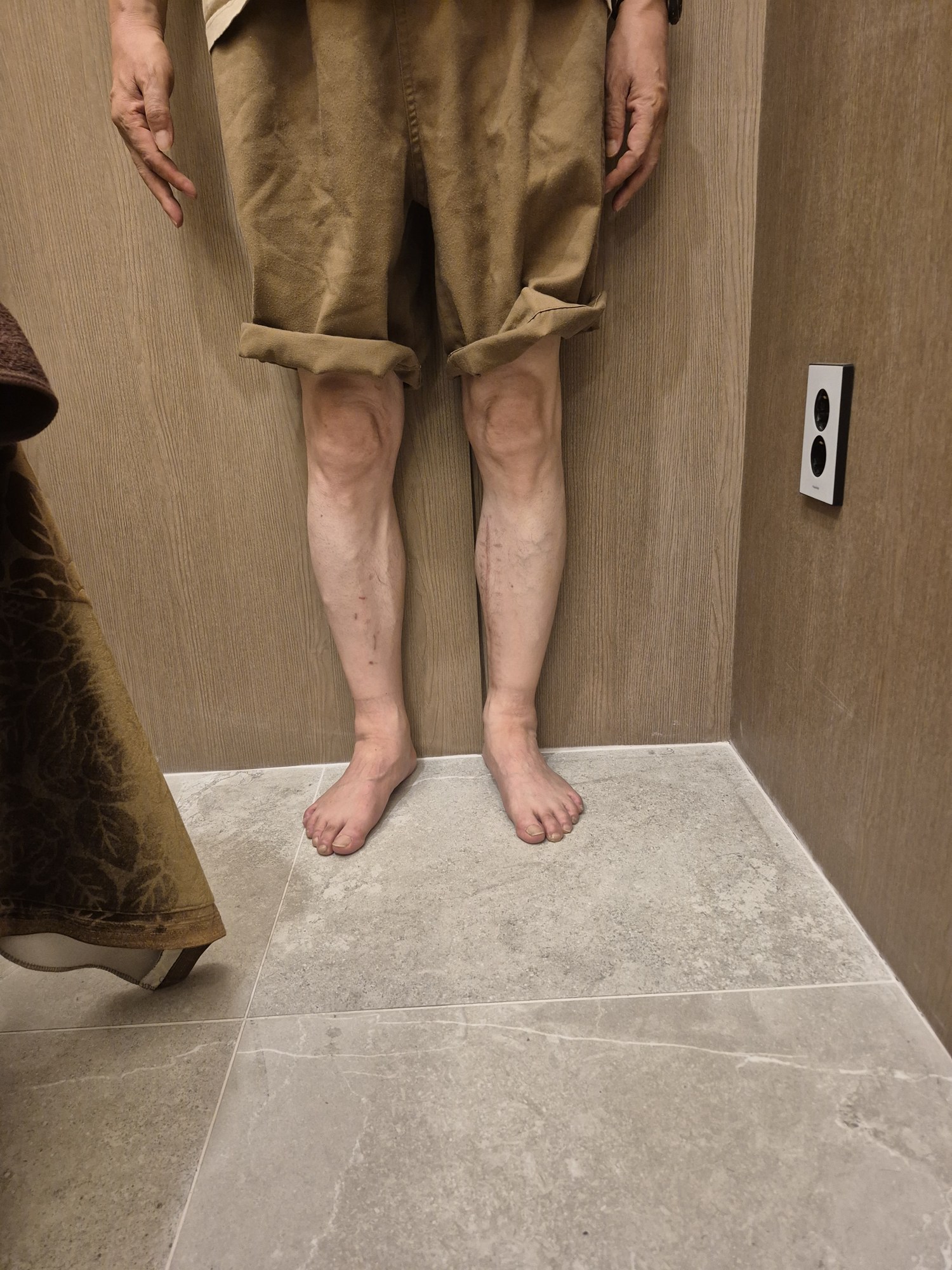 관리 전 비교 사진